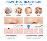 Aparat facial M-2005 Meanersu pentru puncte negre