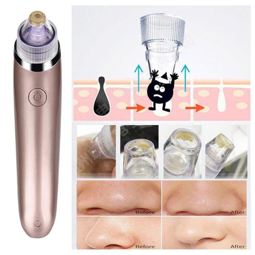 Aparat Curatare Faciala, Vacuum, Scos Puncte Negre